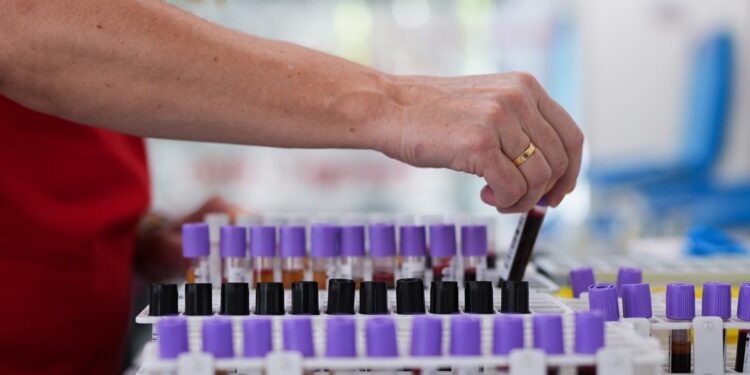 Llamamiento urgente para donar sangre y aumentar las reservas